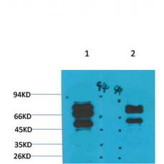 Anti-GABA A Receptor γ2 antibody