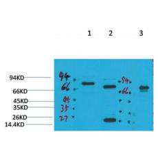 Anti-KCNN2 (SK2) antibody