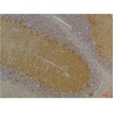Anti-KCNN3 (SK3) antibody