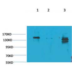 Anti-SLC12A4 antibody