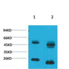 Anti-Kv1.8 antibody
