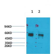 Anti-Kv11.1 antibody