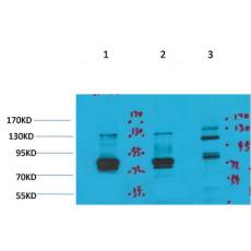 Anti-Kv11.3 antibody