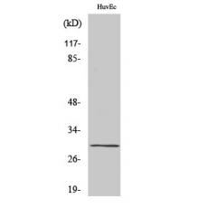 Anti-CD70 antibody