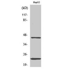 Anti-CD83 antibody