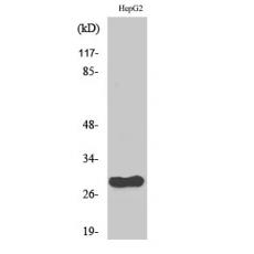 Anti-CdcA3 antibody