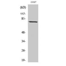 Anti-Bmx antibody
