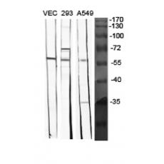 Anti-BMP-5 antibody