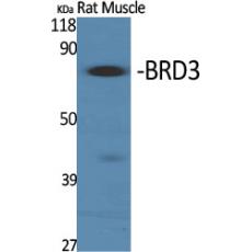 Anti-BRD3 antibody