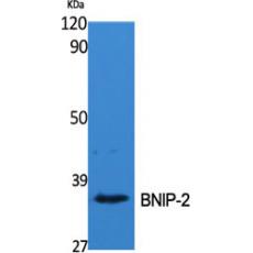 Anti-BNIP-2 antibody
