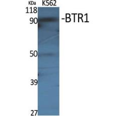 Anti-BTR1 antibody