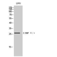 Anti-C/EBP δ/ε antibody