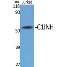 Anti-C1INH antibody