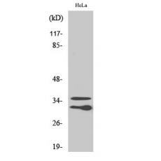 Anti-C1qL2 antibody