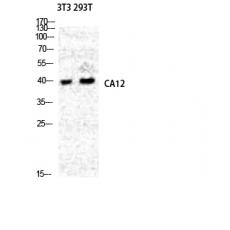 Anti-CA XII antibody