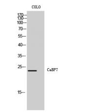Anti-CaBP7 antibody