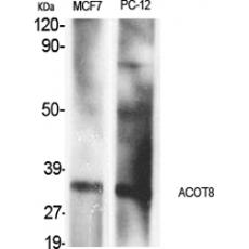 Anti-ACOT8 antibody