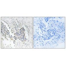 Anti-ACOT1 antibody