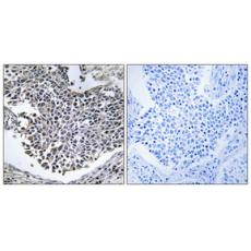 Anti-ABHD9 antibody