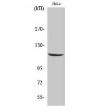 Anti-CARD 6 antibody