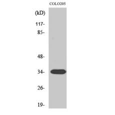 Anti-Calponin 2 antibody