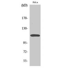 Anti-CARD 10 antibody