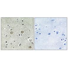 Anti-ABHD8 antibody