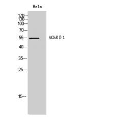 Anti-AChRβ1 antibody
