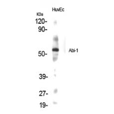 Anti-Abi-1 antibody
