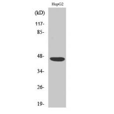 Anti-CAR antibody