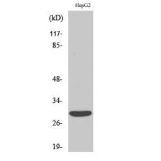 Anti-ACBD6 antibody