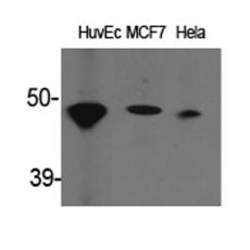 Anti-ACAT-1 antibody