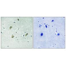 Anti-Casein Kinase Iγ1/2/3 antibody