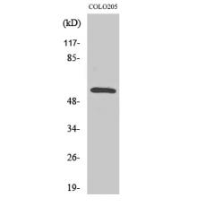 Anti-CaMKIIβ/γ antibody