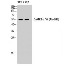 Anti-CaMKIIα/δ antibody