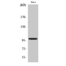 Anti-Catenin-α E/N antibody