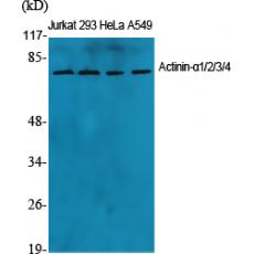 Anti-Actinin-α1/2/3/4 antibody