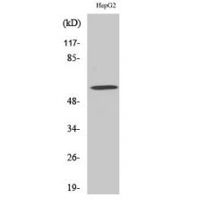 Anti-ADCK4 antibody
