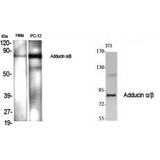 Anti-Adducin α/β antibody