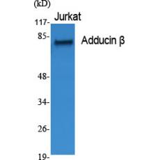 Anti-Adducin β antibody