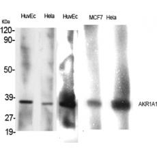 Anti-AKAP 95 antibody