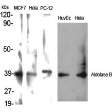Anti-Aldolase B antibody