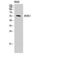 Anti-ALK-1 antibody