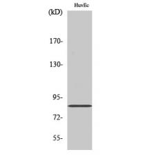 Anti-ALS2CR8 antibody