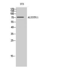 Anti-ALS2CR11 antibody