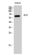 Anti-ALS antibody