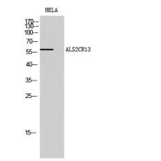 Anti-ALS2CR13 antibody