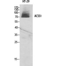 Anti-ACSS1 antibody