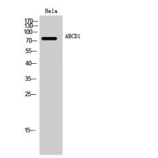 Anti-ABCD1 antibody