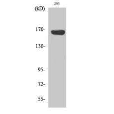 Anti-ABCC12 antibody